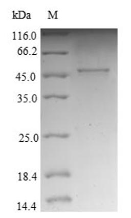 (Tris-Glycine gel) Discontinuous SDS-PAGE (reduced) with 5% enrichment gel and 15% separation gel.