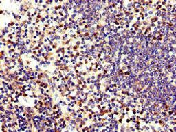 Immunohistochemistry of paraffin-embedded human spleen tissue using CSB-PA007587LA01HU at dilution of 1:100