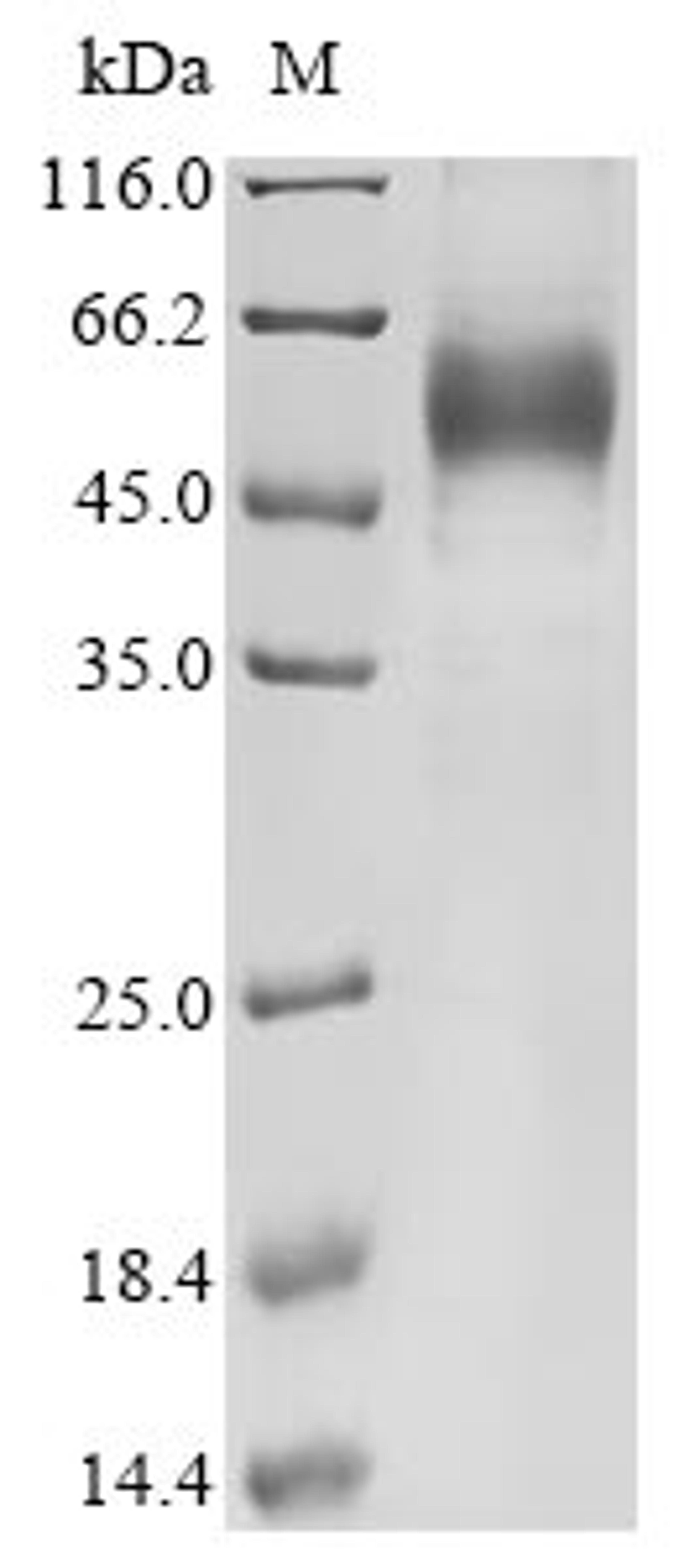 (Tris-Glycine gel) Discontinuous SDS-PAGE (reduced) with 5% enrichment gel and 15% separation gel.