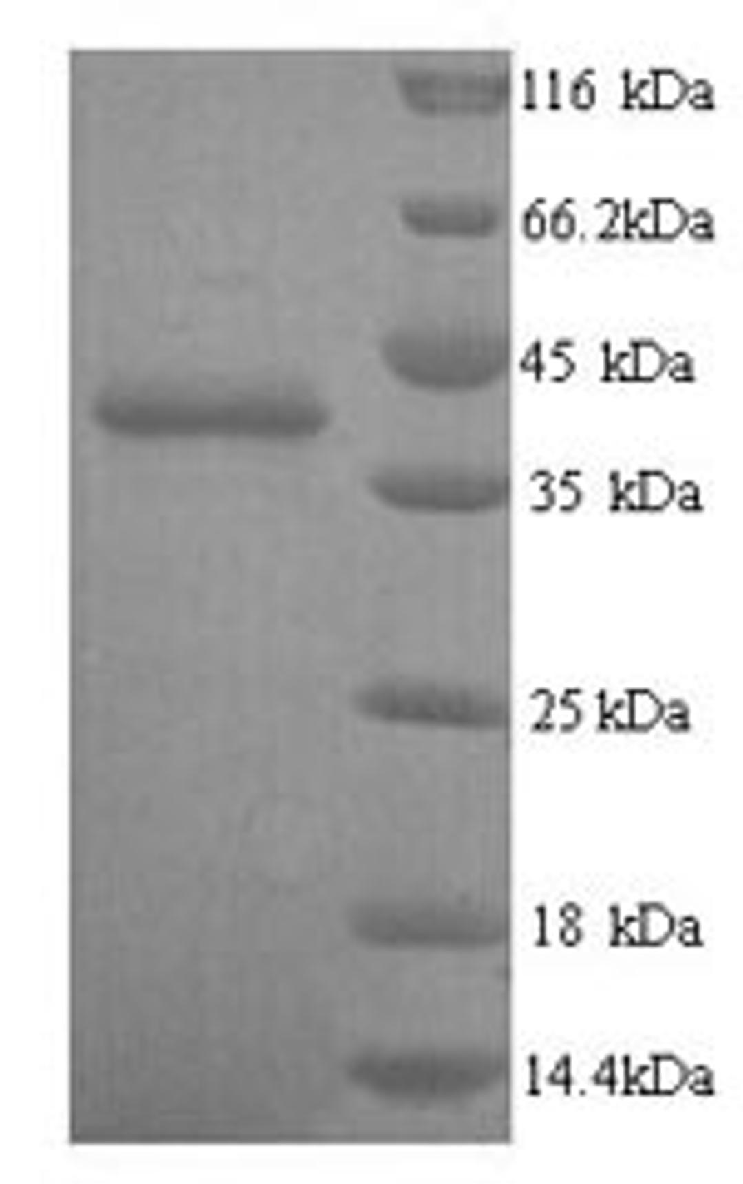 (Tris-Glycine gel) Discontinuous SDS-PAGE (reduced) with 5% enrichment gel and 15% separation gel.
