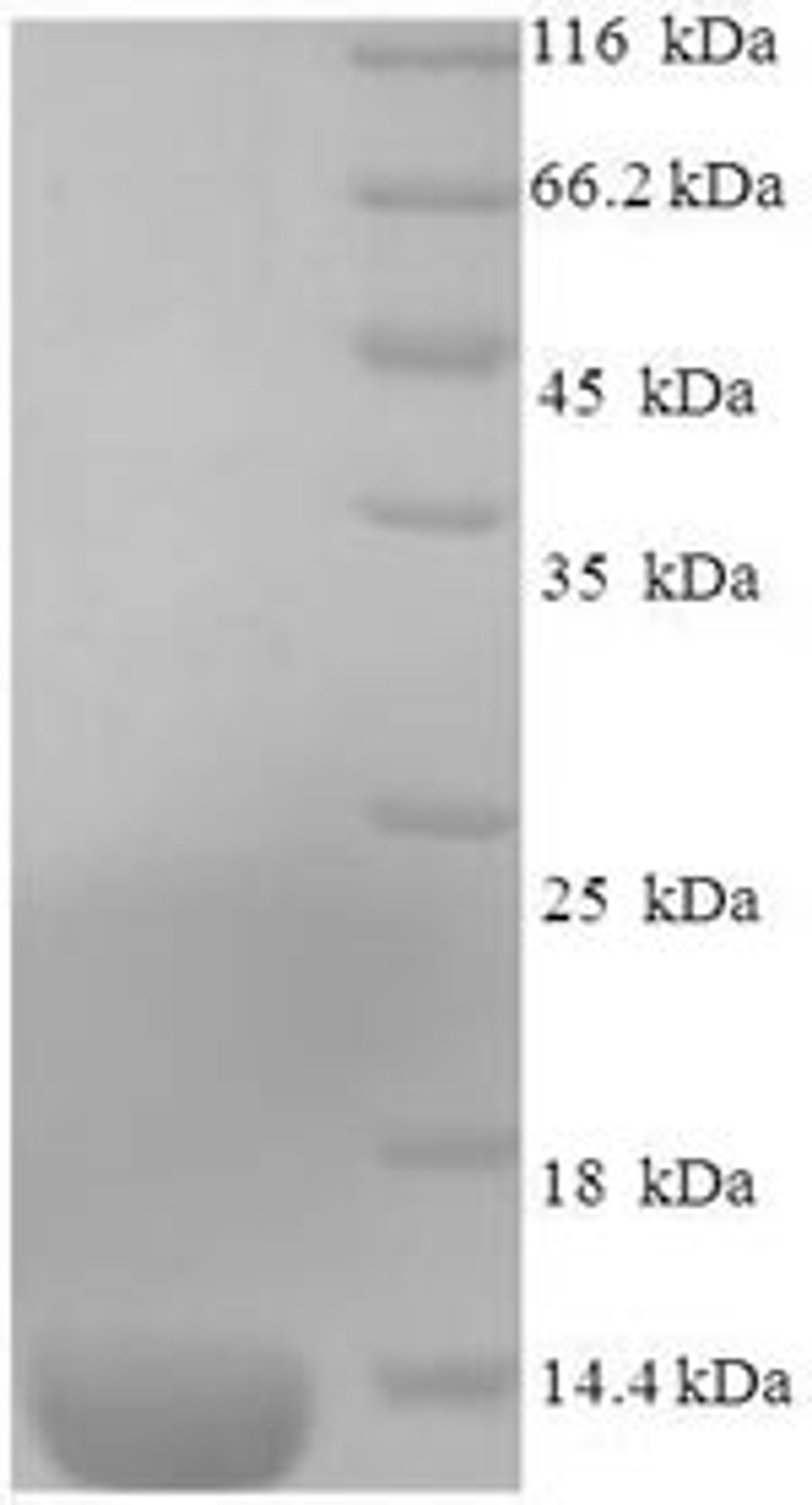 (Tris-Glycine gel) Discontinuous SDS-PAGE (reduced) with 5% enrichment gel and 15% separation gel.