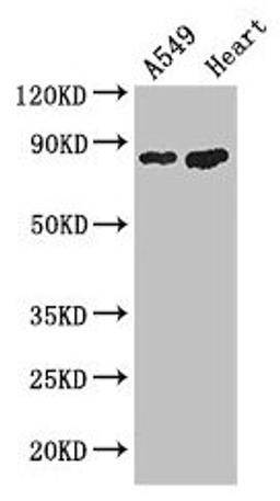 Western Blot. Positive WB detected in: A549 whole cell lysate, Mouse heart tissue. All lanes: PFKM antibody at 3.4µg/ml. Secondary. Goat polyclonal to rabbit IgG at 1/50000 dilution. Predicted band size: 86, 82, 94 kDa. Observed band size: 86 kDa