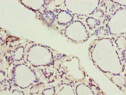 Immunohistochemistry of paraffin-embedded human thyroid tissue using CSB-PA878904LA01HU at dilution of 1:100