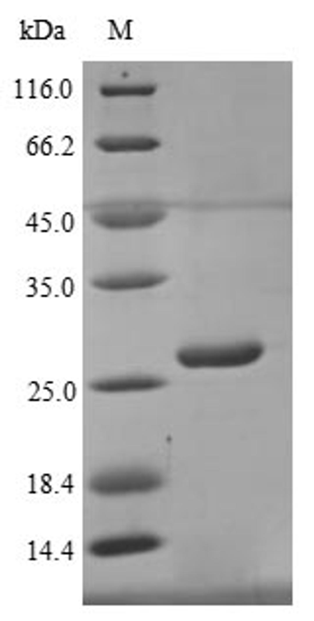 (Tris-Glycine gel) Discontinuous SDS-PAGE (reduced) with 5% enrichment gel and 15% separation gel.