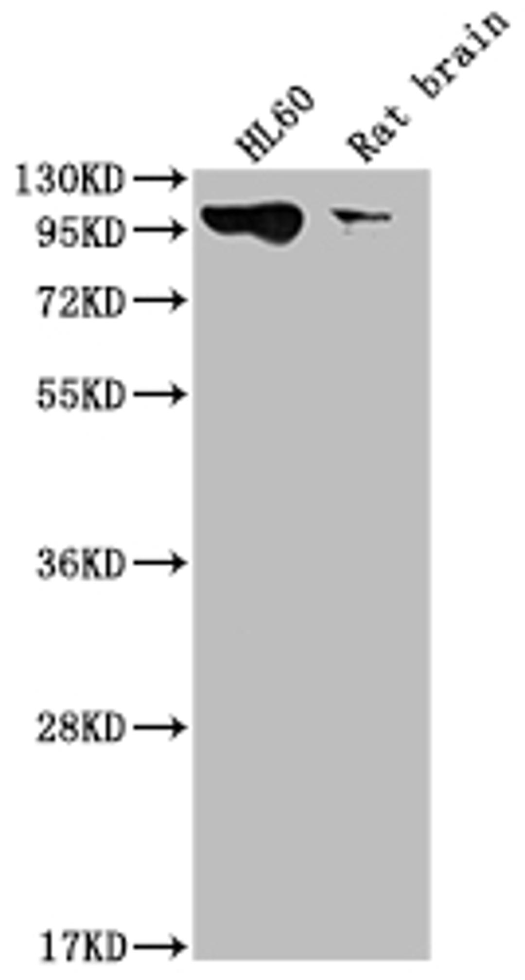 Western Blot. Positive WB detected in: HL60 whole cell lysate, Rat brain tissue. All lanes: DNM2 antibody at 1:2000. Secondary. Goat polyclonal to rabbit IgG at 1/50000 dilution. Predicted band size: 99, 98 kDa. Observed band size: 99 kDa. 