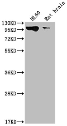 Western Blot. Positive WB detected in: HL60 whole cell lysate, Rat brain tissue. All lanes: DNM2 antibody at 1:2000. Secondary. Goat polyclonal to rabbit IgG at 1/50000 dilution. Predicted band size: 99, 98 kDa. Observed band size: 99 kDa.