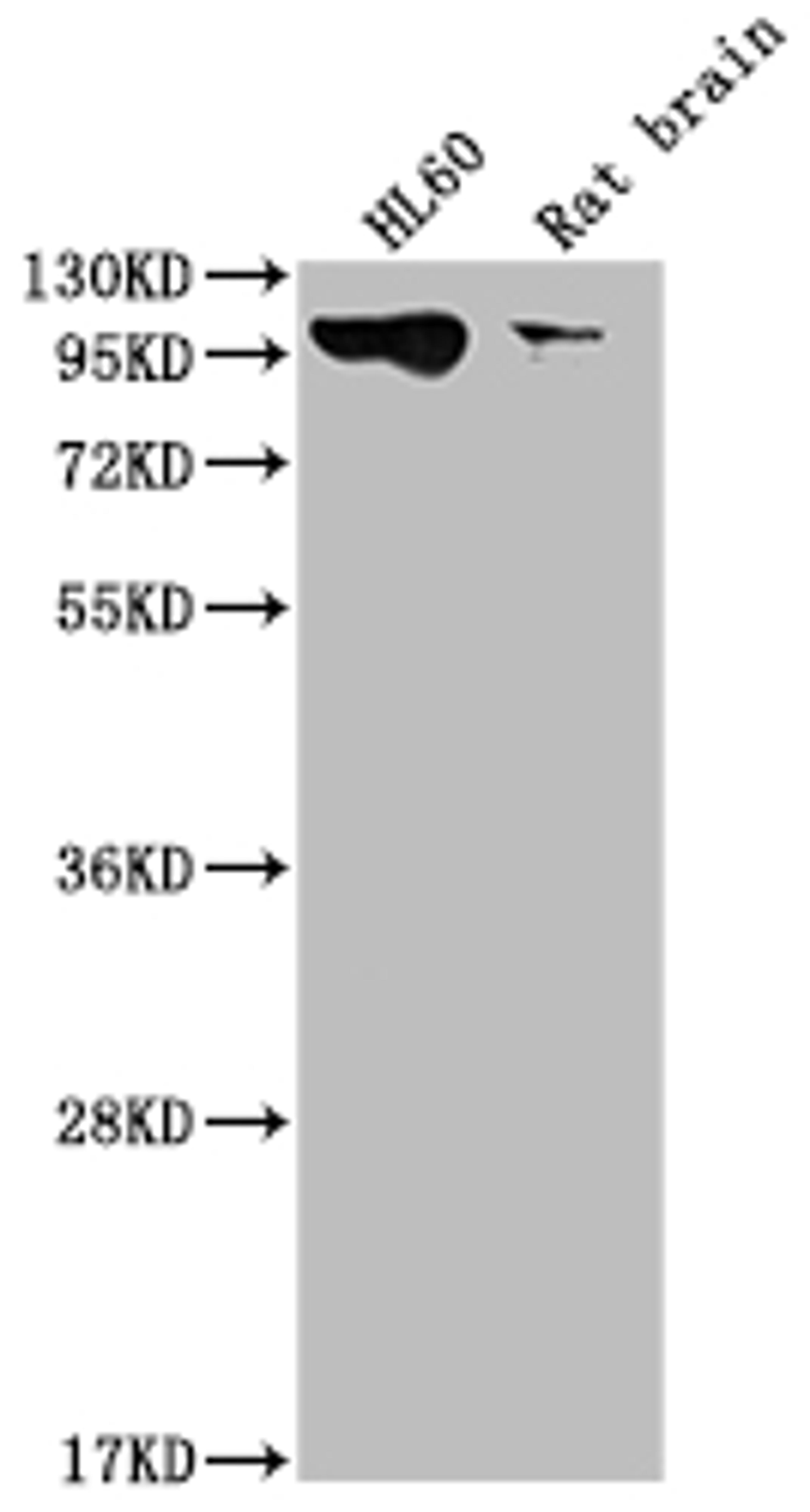 Western Blot. Positive WB detected in: HL60 whole cell lysate, Rat brain tissue. All lanes: DNM2 antibody at 1:2000. Secondary. Goat polyclonal to rabbit IgG at 1/50000 dilution. Predicted band size: 99, 98 kDa. Observed band size: 99 kDa.