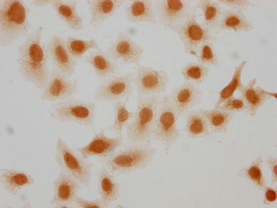 Immunocytochemistry analysis of CSB-PA010389OA95hibHU diluted at 1:10 and staining in Hela cells(treated with 30mM sodium butyrate for 4h) performed on a Leica BondTM system. The cells were fixed in 4% formaldehyde, permeabilized using 0.2% Triton X-100 and blocked with 10% normal goat serum 30min at RT. Then primary antibody (1% BSA) was incubated at 4°C overnight. The primary is detected by a biotinylated secondary antibody and visualized using an HRP conjugated SP system.