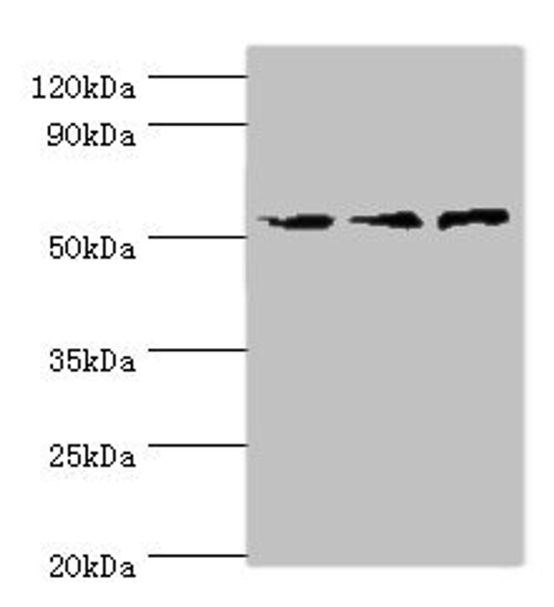 Western blot. All lanes: ACVR1C antibody at 4ug/ml. Lane 1: Mouse brain tissue. Lane 2: HepG2 whole cell lysate. Lane 3: Hela whole cell lysate. Secondary. Goat polyclonal to rabbit IgG at 1/10000 dilution. Predicted band size: 55, 38, 47, 50 kDa. Observed band size: 55 kDa. 