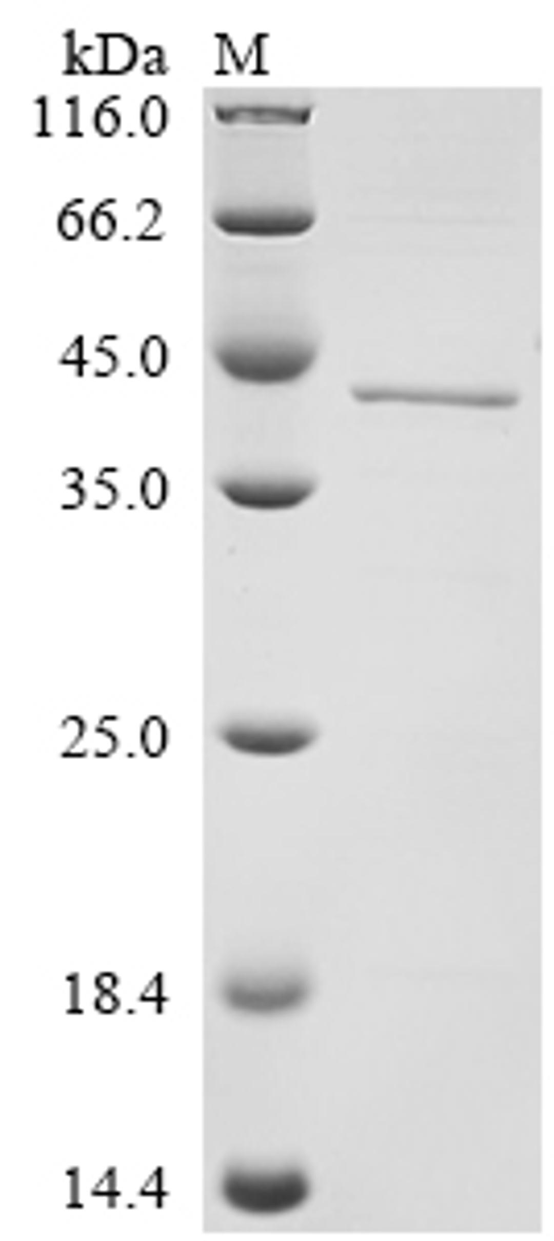 (Tris-Glycine gel) Discontinuous SDS-PAGE (reduced) with 5% enrichment gel and 15% separation gel.
