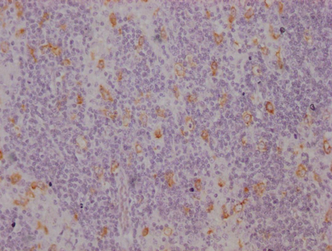 IHC image of CSB-MA942955 diluted at 1:100 and staining in paraffin-embedded human lymph node tissue performed on a Leica BondTM system. After dewaxing and hydration, antigen retrieval was mediated by high pressure in a citrate buffer (pH 6.0). Section was blocked with 10% normal goat serum 30min at RT. Then primary antibody (1% BSA) was incubated at 4°C overnight. The primary is detected by a Goat anti-mouse IgG polymer labeled by HRP and visualized using 0.05% DAB.