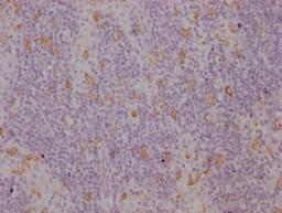IHC image of CSB-MA942955 diluted at 1:100 and staining in paraffin-embedded human lymph node tissue performed on a Leica BondTM system. After dewaxing and hydration, antigen retrieval was mediated by high pressure in a citrate buffer (pH 6.0). Section was blocked with 10% normal goat serum 30min at RT. Then primary antibody (1% BSA) was incubated at 4°C overnight. The primary is detected by a Goat anti-mouse IgG polymer labeled by HRP and visualized using 0.05% DAB.