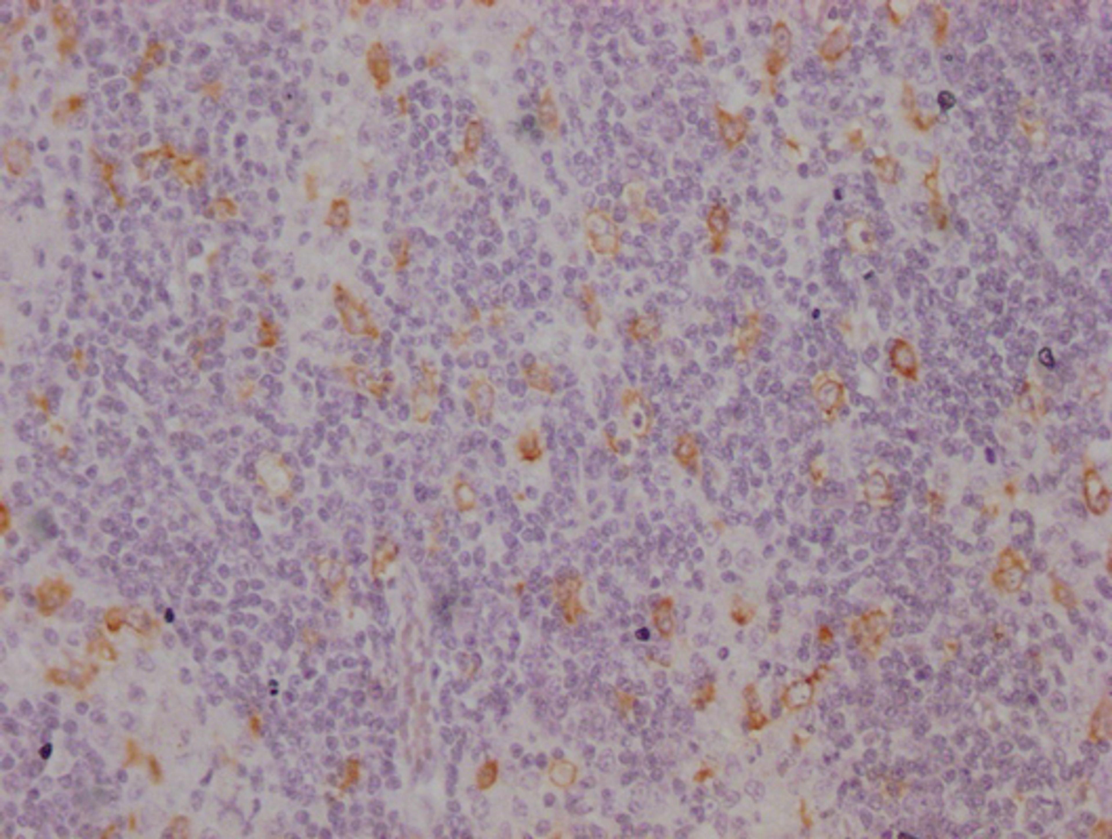 IHC image of CSB-MA942955 diluted at 1:100 and staining in paraffin-embedded human lymph node tissue performed on a Leica BondTM system. After dewaxing and hydration, antigen retrieval was mediated by high pressure in a citrate buffer (pH 6.0). Section was blocked with 10% normal goat serum 30min at RT. Then primary antibody (1% BSA) was incubated at 4°C overnight. The primary is detected by a Goat anti-mouse IgG polymer labeled by HRP and visualized using 0.05% DAB.