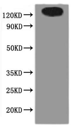 CSB-MP866221HU(A4) is detected by Mouse anti-6*His monoclonal antibody.