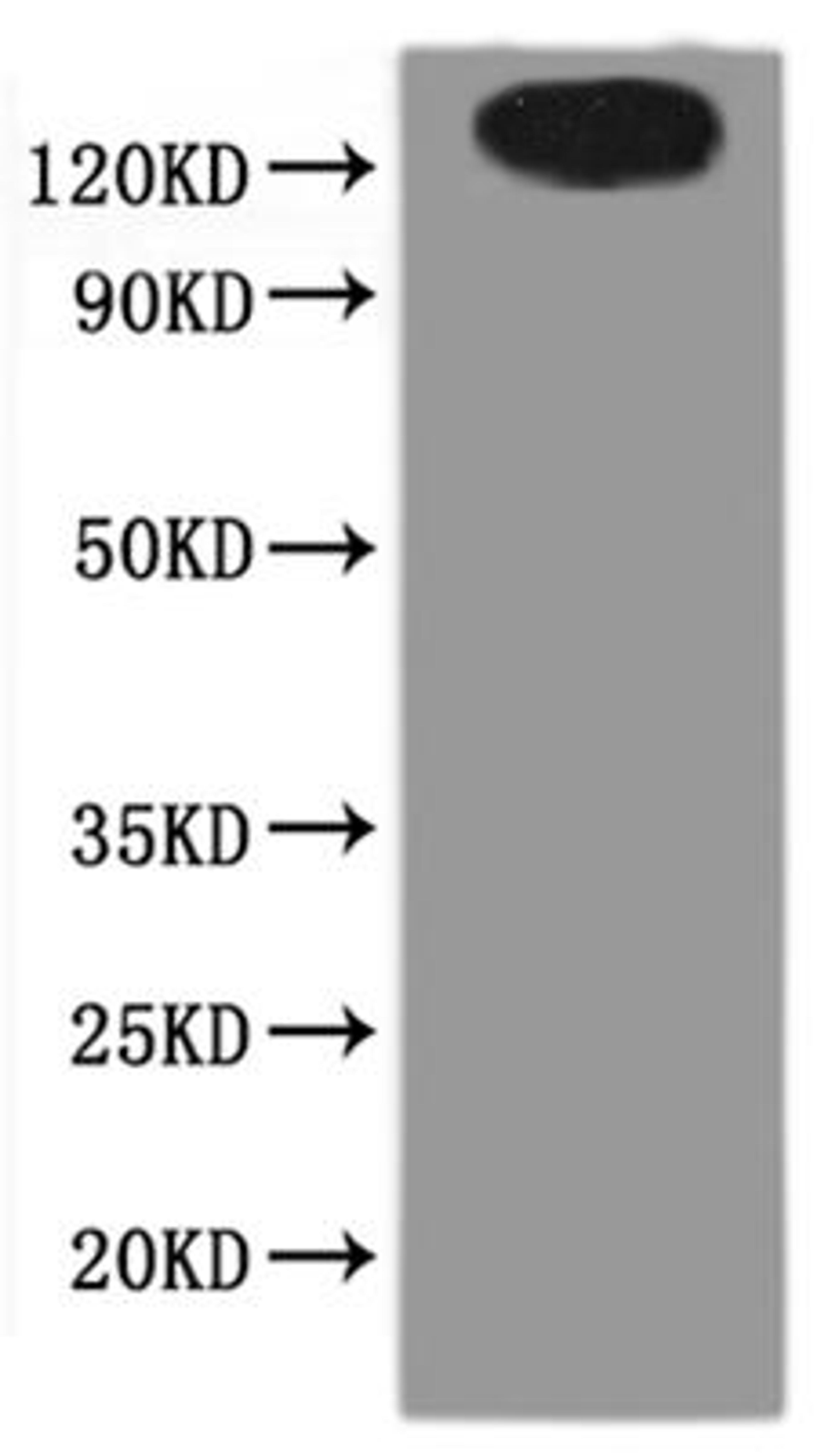 CSB-MP866221HU(A4) is detected by Mouse anti-6*His monoclonal antibody.