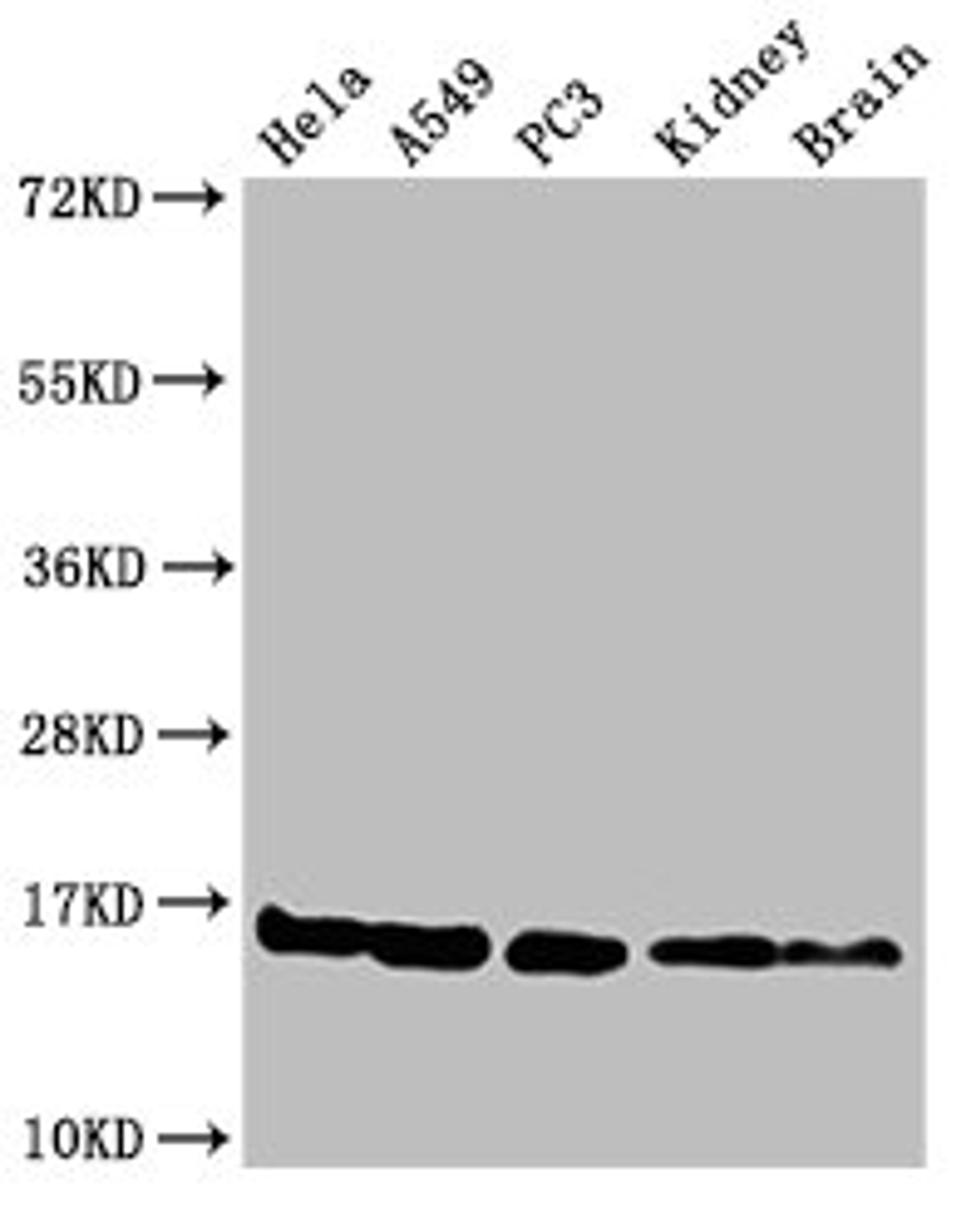 Western Blot. Positive WB detected in: Hela cell acid extracts, A549 cell acid extracts, PC-3 cell acid extracts, Mouse kidney tissue, Mouse brain tissue. All lanes: HIST1H3A antibody at 2µg/ml. Secondary. Goat polyclonal to rabbit IgG at 1/50000 dilution. Predicted band size: 16 kDa. Observed band size: 16 kDa