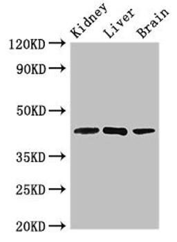 Western Blot. Positive WB detected in: Mouse kidney tissue, Rat liver tissue, Rat brain tissue. All lanes: KLF12 antibody at 2.5ug/ml. Secondary. Goat polyclonal to rabbit IgG at 1/50000 dilution. Predicted band size: 45, 29, 34 kDa. Observed band size: 45 kDa. 