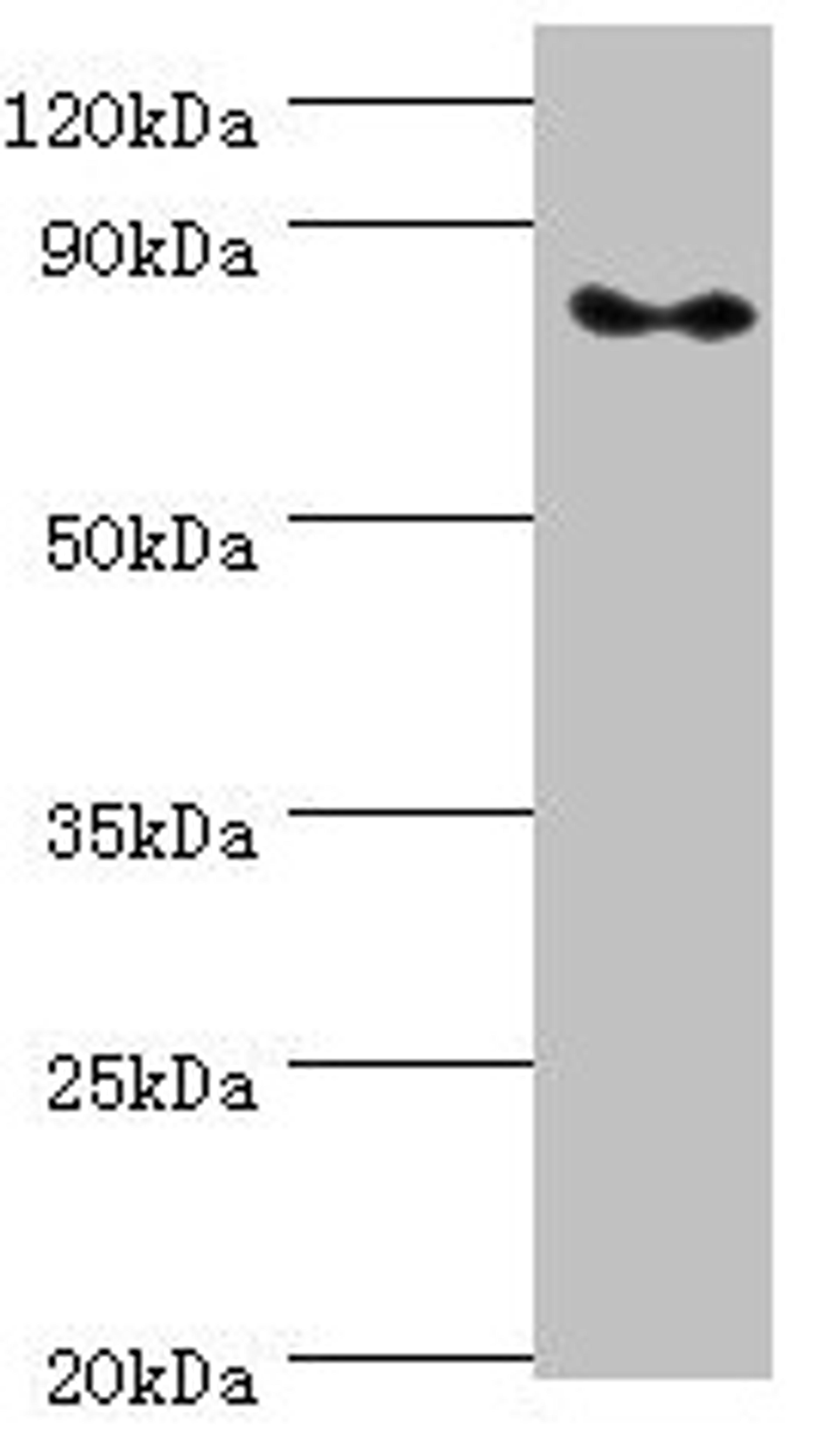 Western blot. All lanes: ATRIP antibody at 2µg/ml + PC-3 whole cell lysate. Secondary. Goat polyclonal to rabbit IgG at 1/10000 dilution. Predicted band size: 86, 84, 77, 73 kDa. Observed band size: 86 kDa