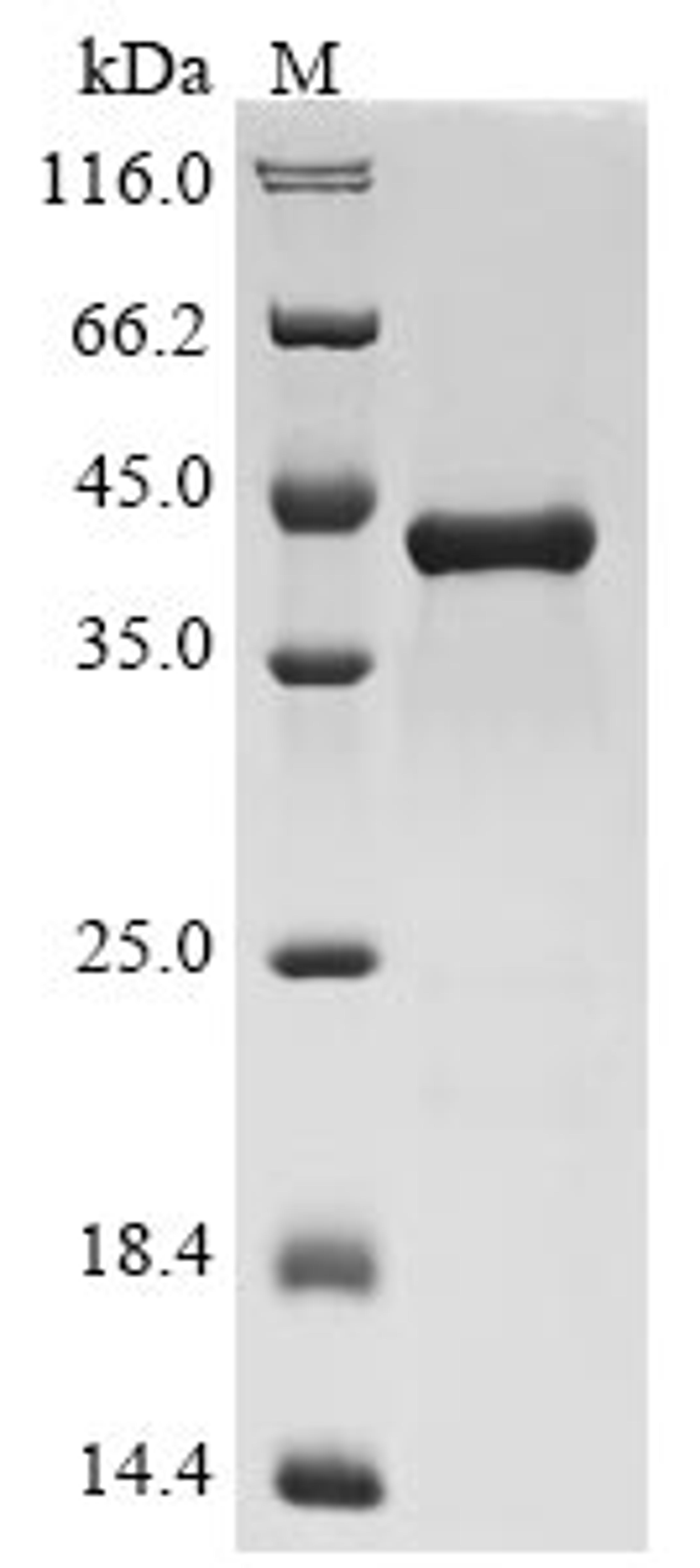 (Tris-Glycine gel) Discontinuous SDS-PAGE (reduced) with 5% enrichment gel and 15% separation gel.
