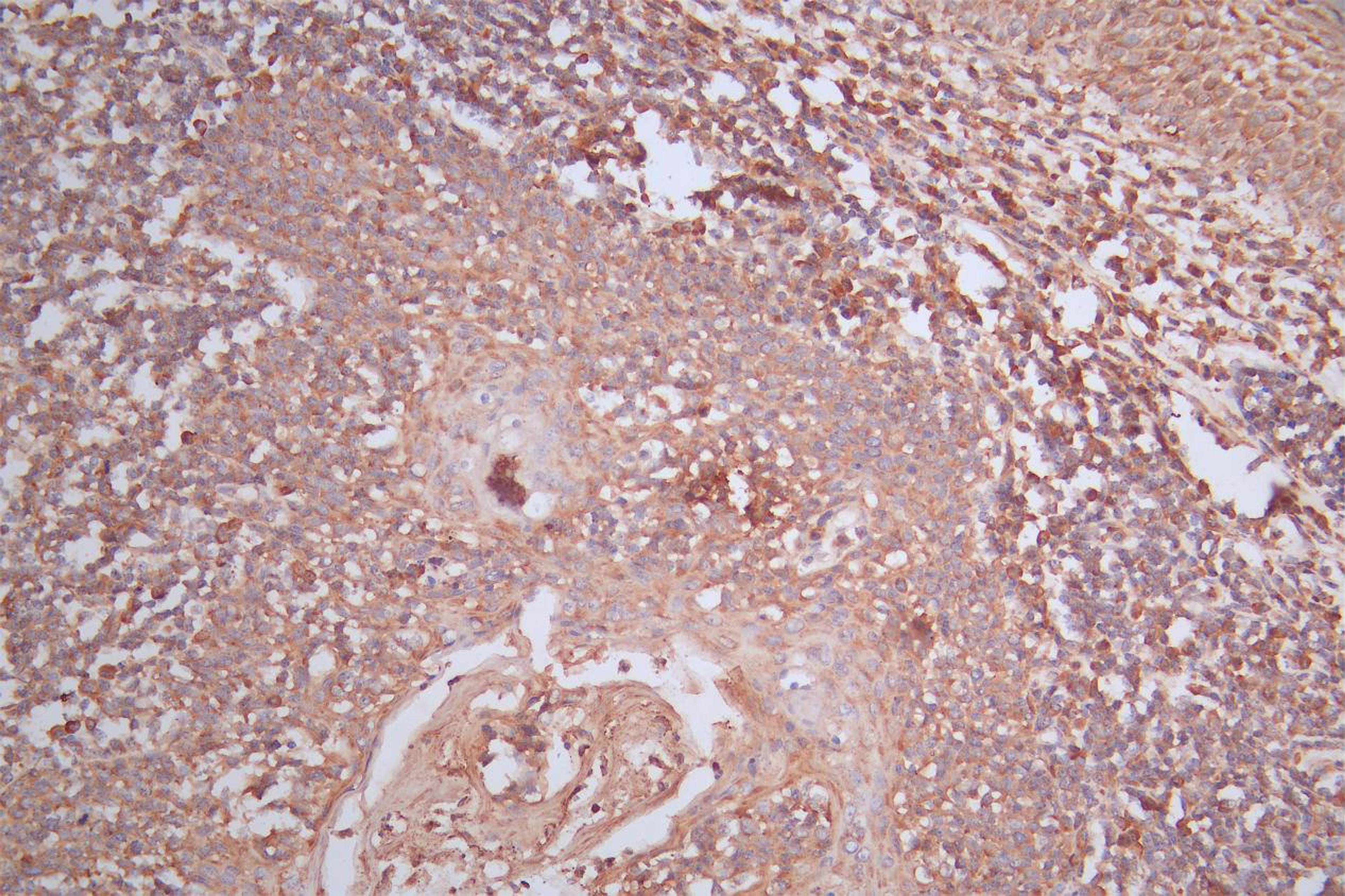 IHC image of CSB-RA015007MA4HU diluted at 1:200 and staining in paraffin-embedded human tonsil tissue performed on a Leica BondTM system. After dewaxing and hydration, antigen retrieval was mediated by high pressure in a citrate buffer (pH 6.0). Section was blocked with 10% normal goat serum 30min at RT. Then primary antibody (1% BSA) was incubated at 4°C overnight. The primary is detected by a Goat anti-Mouse IgG labeled by HRP and visualized using 0.05% DAB.