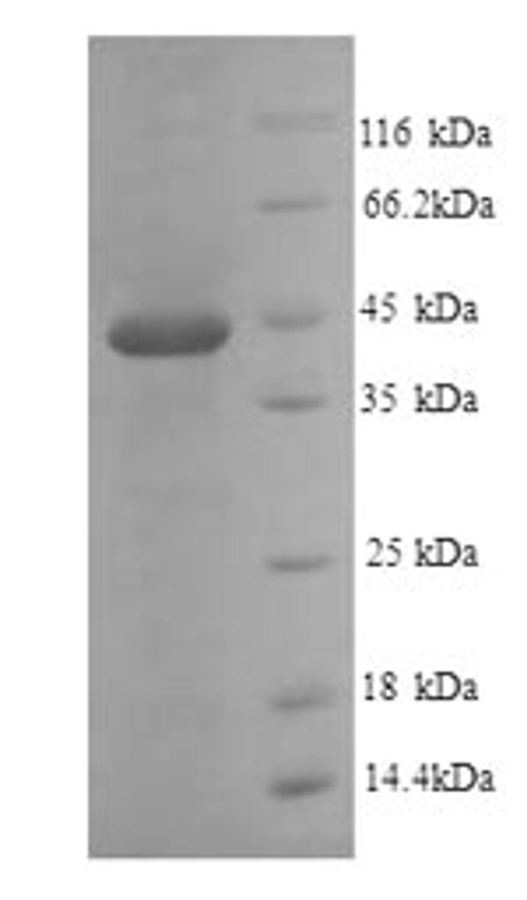 (Tris-Glycine gel) Discontinuous SDS-PAGE (reduced) with 5% enrichment gel and 15% separation gel.
