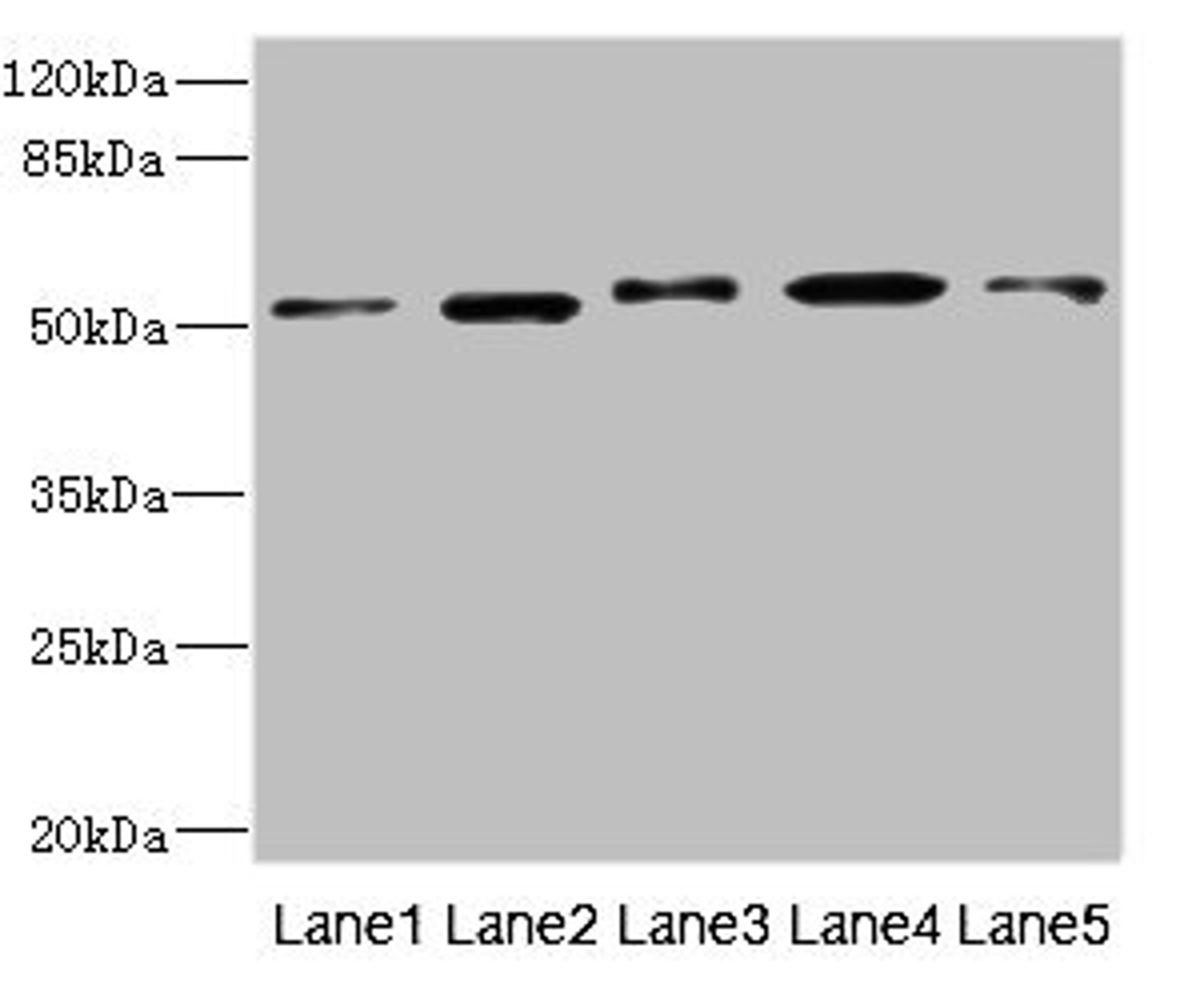 Western blot. All lanes: NFKBIE antibody at 4.17ug/ml. Lane 1: Mouse liver tissue. Lane 2: Hela whole cell lysate. Lane 3: Jurkat whole cell lysate. Lane 4: A375 whole cell lysate. Lane 5: 293T whole cell lysate. Secondary. Goat polyclonal to rabbit IgG at 1/10000 dilution. Predicted band size: 53 kDa. Observed band size: 53 kDa. 