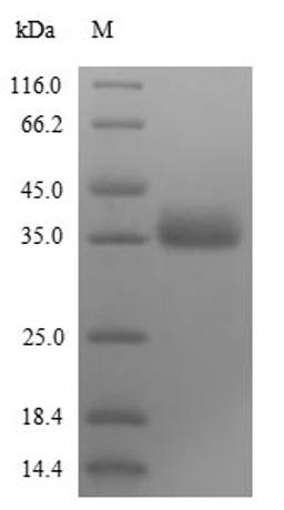 (Tris-Glycine gel) Discontinuous SDS-PAGE (reduced) with 5% enrichment gel and 15% separation gel.