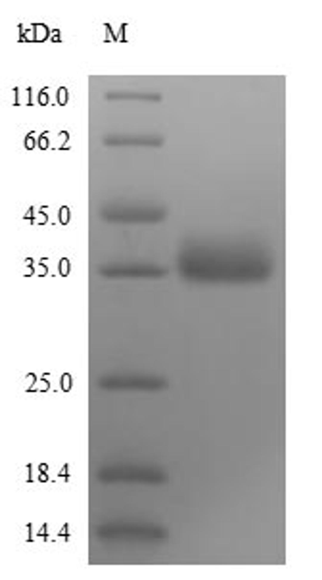 (Tris-Glycine gel) Discontinuous SDS-PAGE (reduced) with 5% enrichment gel and 15% separation gel.