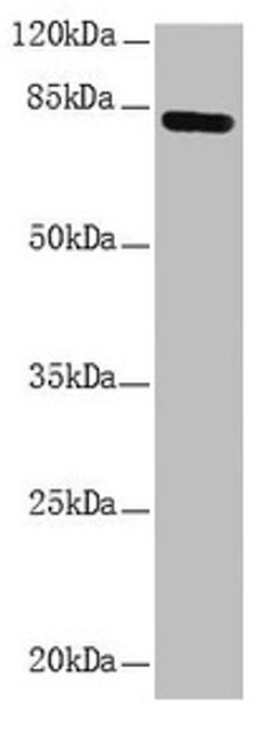 Western blot. All lanes: NDUFS1 antibody at 1.15µg/ml + HepG2 whole cell lysate. Secondary. Goat polyclonal to rabbit IgG at 1/10000 dilution. Predicted band size: 80, 81, 68, 74, 76 kDa. Observed band size: 80 kDa
