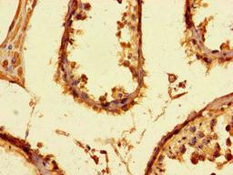 Immunohistochemistry of paraffin-embedded human testis tissue using CSB-PA856972HA01HU at dilution of 1:100