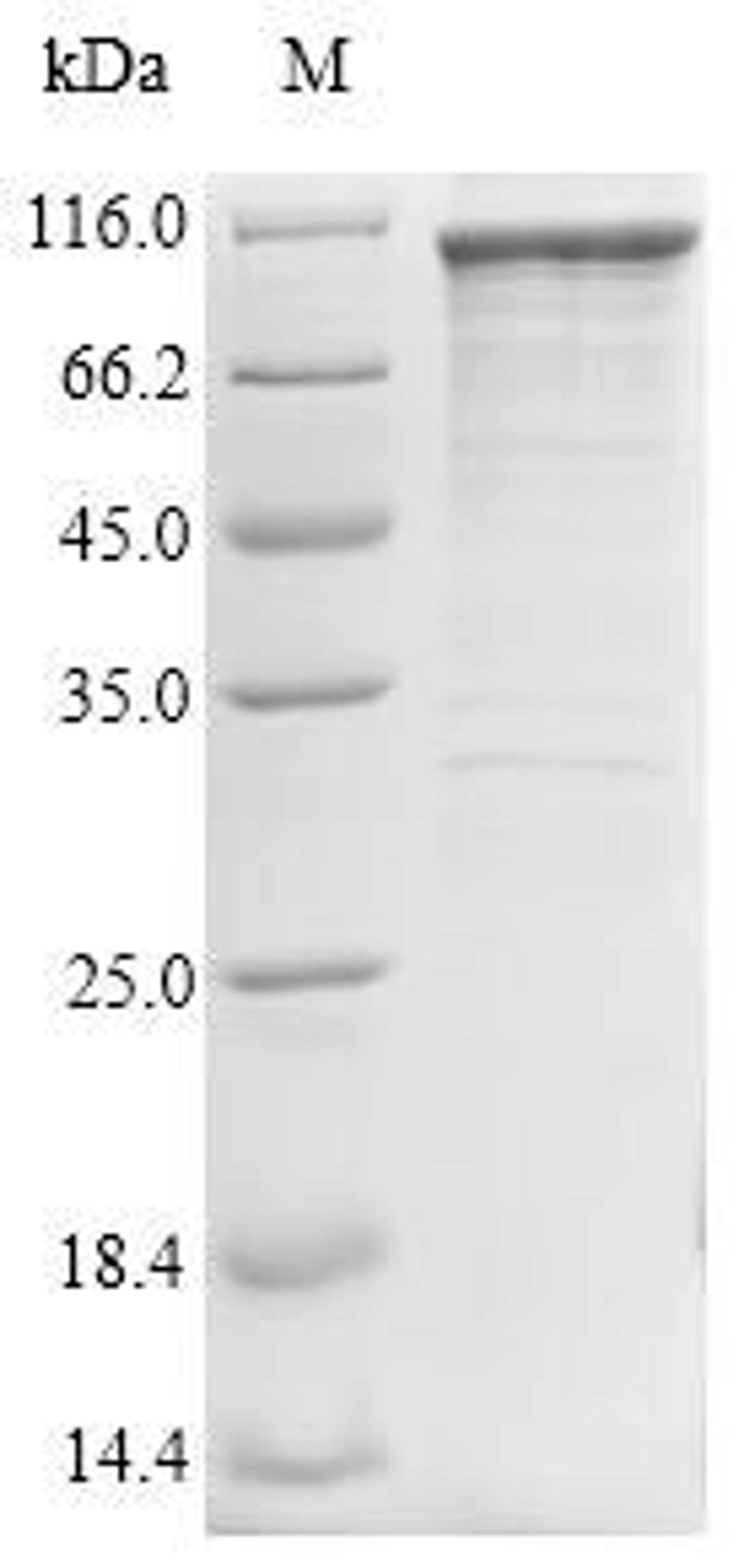 (Tris-Glycine gel) Discontinuous SDS-PAGE (reduced) with 5% enrichment gel and 15% separation gel.