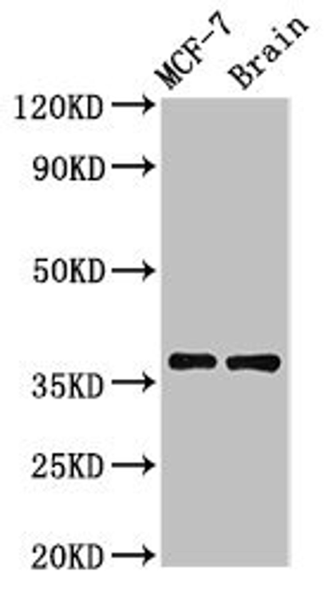 Western Blot. Positive WB detected in: MCF-7 whole cell lysate, Rat brain tissue. All lanes: MENT antibody at 3.2µg/ml. Secondary. Goat polyclonal to rabbit IgG at 1/50000 dilution. Predicted band size: 37, 19 kDa. Observed band size: 37 kDa