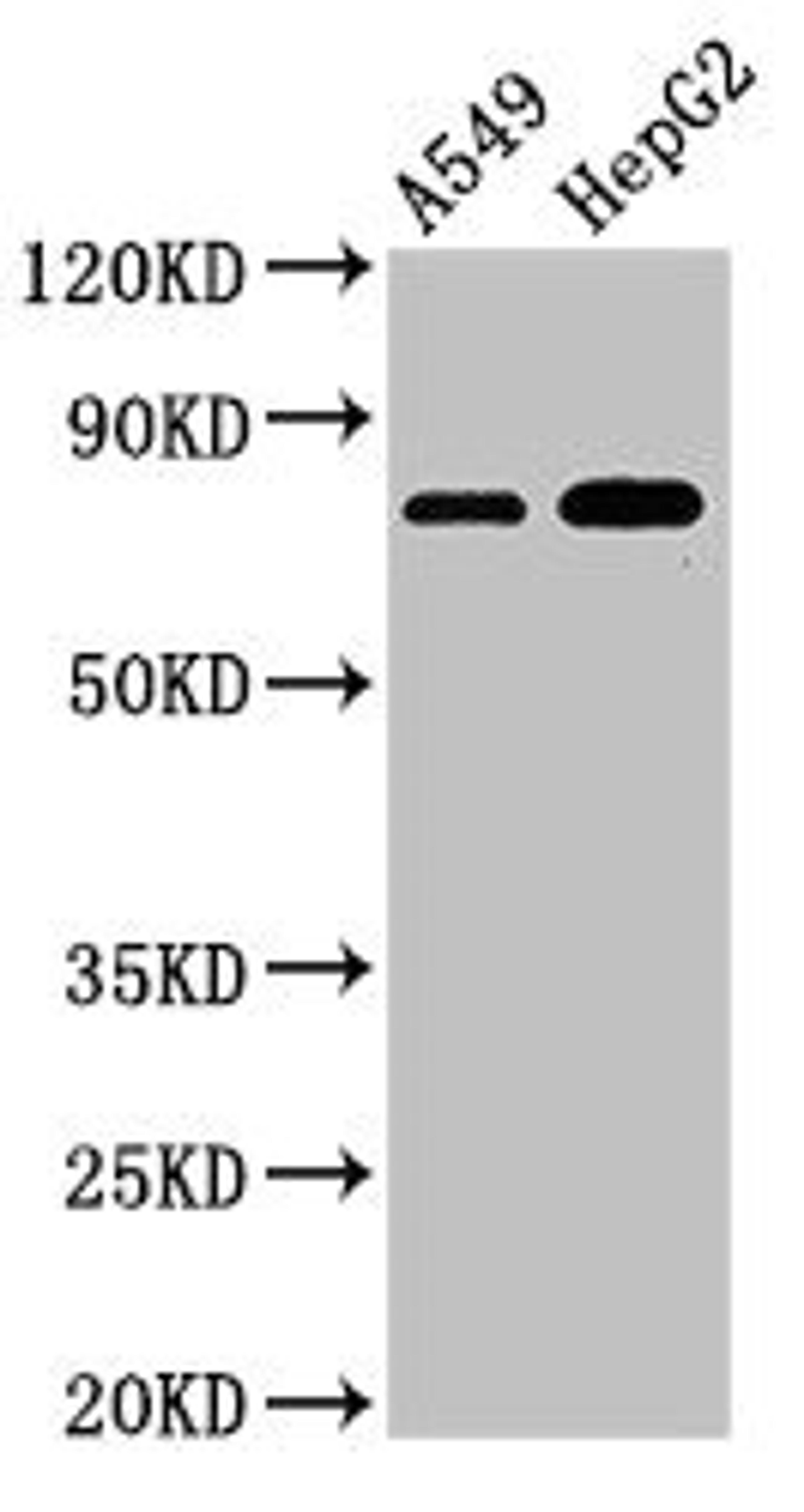 Western Blot. Positive WB detected in: A549 whole cell lysate, HepG2 whole cell lysate. All lanes: TBC1D15 antibody at 3µg/ml. Secondary. Goat polyclonal to rabbit IgG at 1/50000 dilution. Predicted band size: 80, 78, 79 kDa. Observed band size: 80 kDa