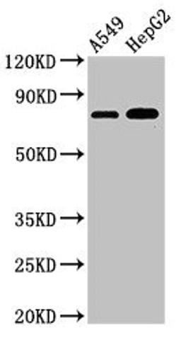 Western Blot. Positive WB detected in: A549 whole cell lysate, HepG2 whole cell lysate. All lanes: TBC1D15 antibody at 3µg/ml. Secondary. Goat polyclonal to rabbit IgG at 1/50000 dilution. Predicted band size: 80, 78, 79 kDa. Observed band size: 80 kDa