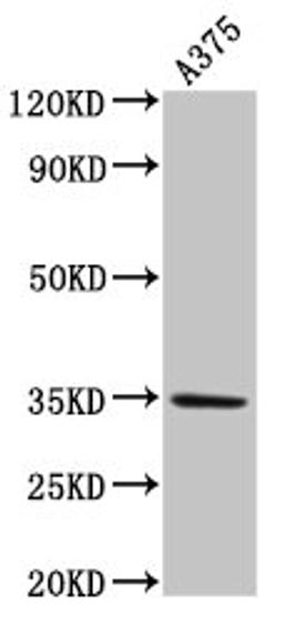 Western Blot. Positive WB detected in: A375 whole cell lysate. All lanes: MC1R antibody at 4µg/ml. Secondary. Goat polyclonal to rabbit IgG at 1/50000 dilution. Predicted band size: 35 kDa. Observed band size: 35 kDa