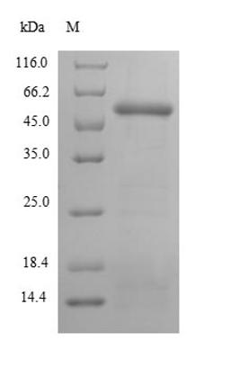 (Tris-Glycine gel) Discontinuous SDS-PAGE (reduced) with 5% enrichment gel and 15% separation gel.