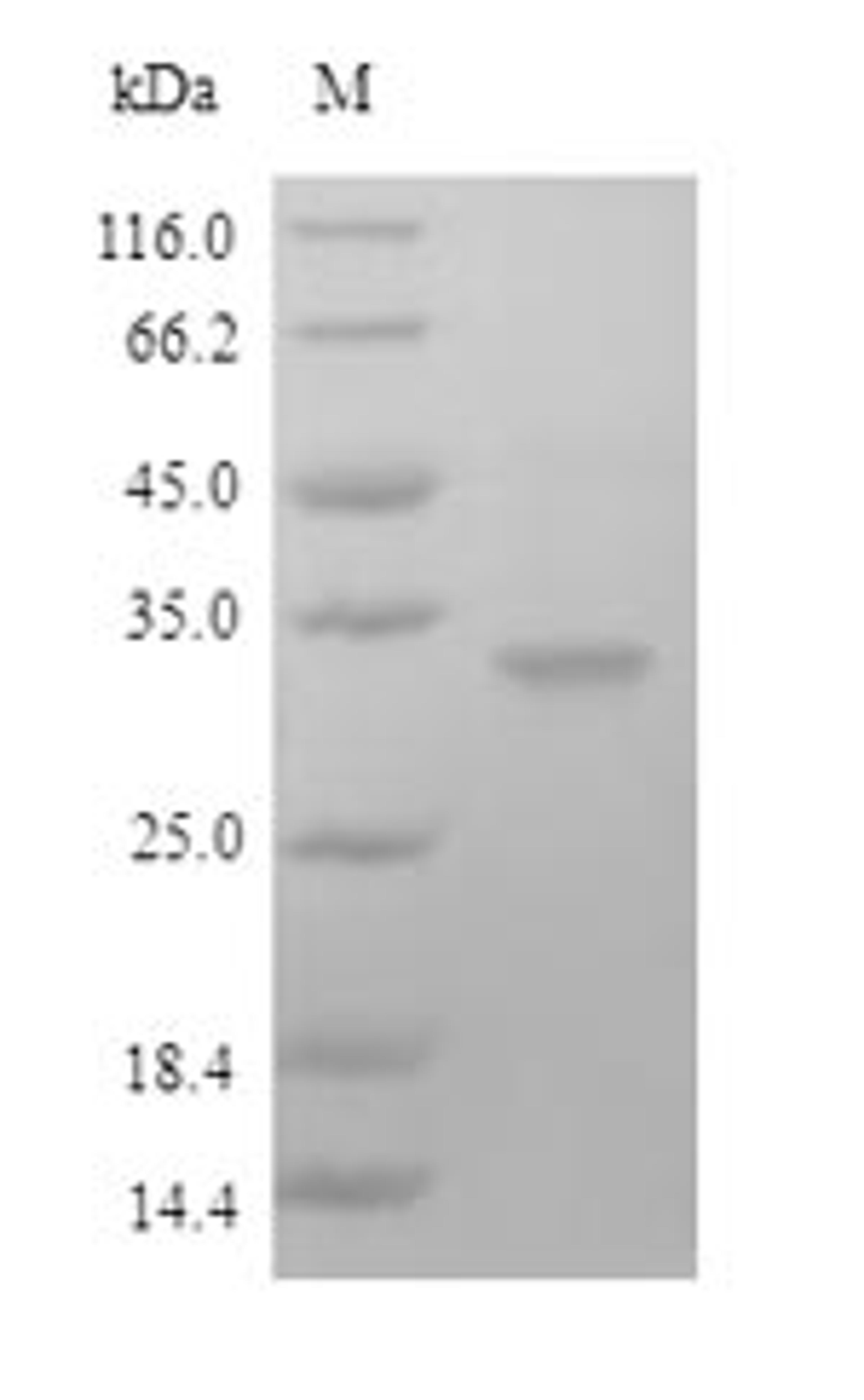 (Tris-Glycine gel) Discontinuous SDS-PAGE (reduced) with 5% enrichment gel and 15% separation gel.