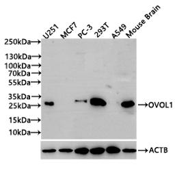 Western BlotPositive WB detected in: U251 whole cell lysate(20µg), MCF7 whole cell lysate(20µg), PC-3 whole cell lysate(20µg), 293T whole cell lysate(20µg), A549 whole cell lysate(20µg),Mouse Brain tissue lysate(20µg)All lanes: OVOL1 antibody at 1:1000SecondaryGoat polyclonal to rabbit IgG at 1/50000 dilutionPredicted band size: 31 kDaObserved band size: 31 kDaExposure time: 30s