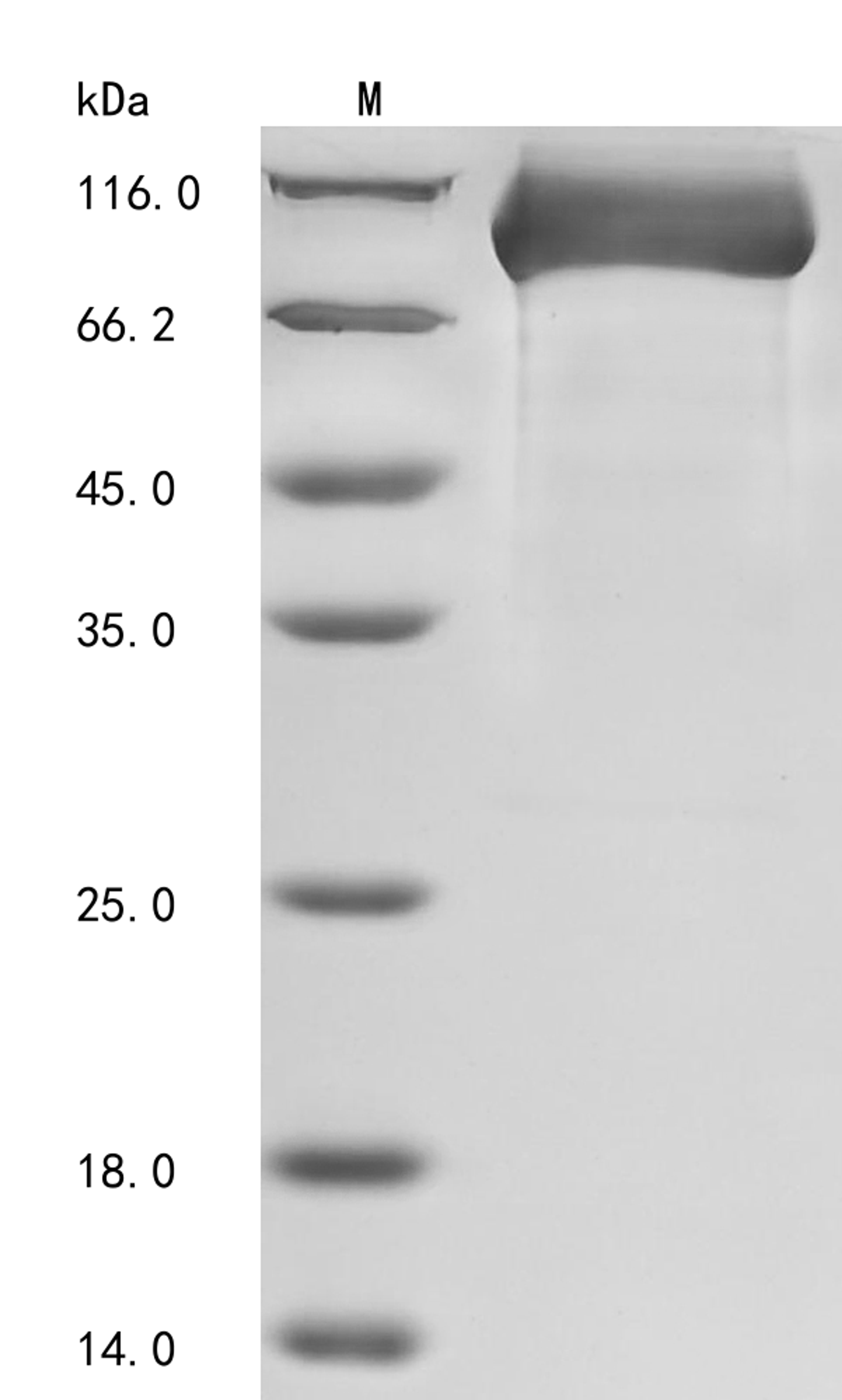 (Tris-Glycine gel) Discontinuous SDS-PAGE (reduced) with 5% enrichment gel and 15% separation gel.
