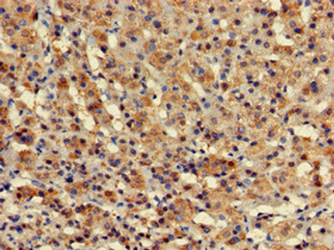 Immunohistochemistry of paraffin-embedded human adrenal gland tissue using CSB-PA21019A0Rb at dilution of 1:100