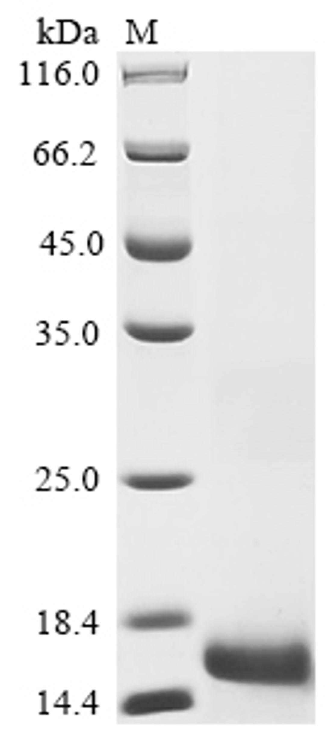 (Tris-Glycine gel) Discontinuous SDS-PAGE (reduced) with 5% enrichment gel and 15% separation gel.