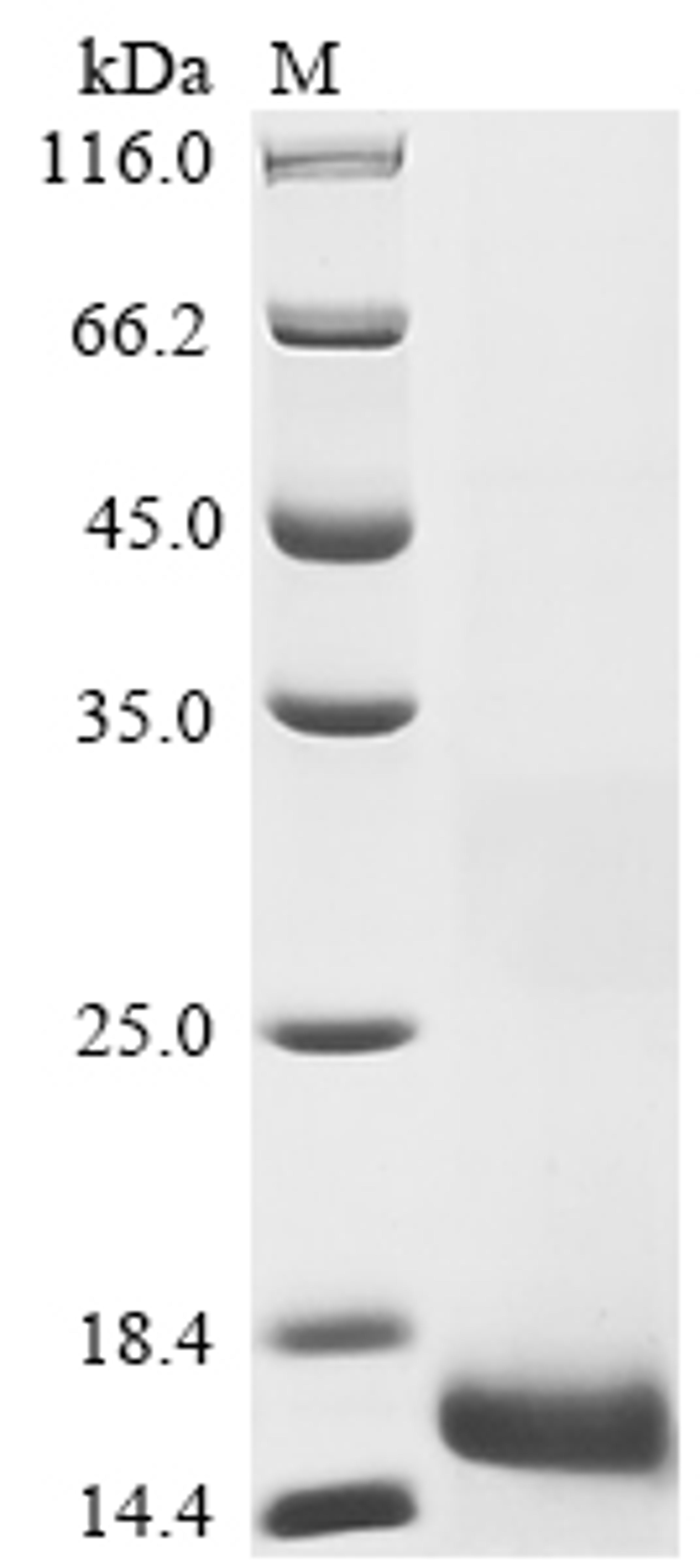 (Tris-Glycine gel) Discontinuous SDS-PAGE (reduced) with 5% enrichment gel and 15% separation gel.
