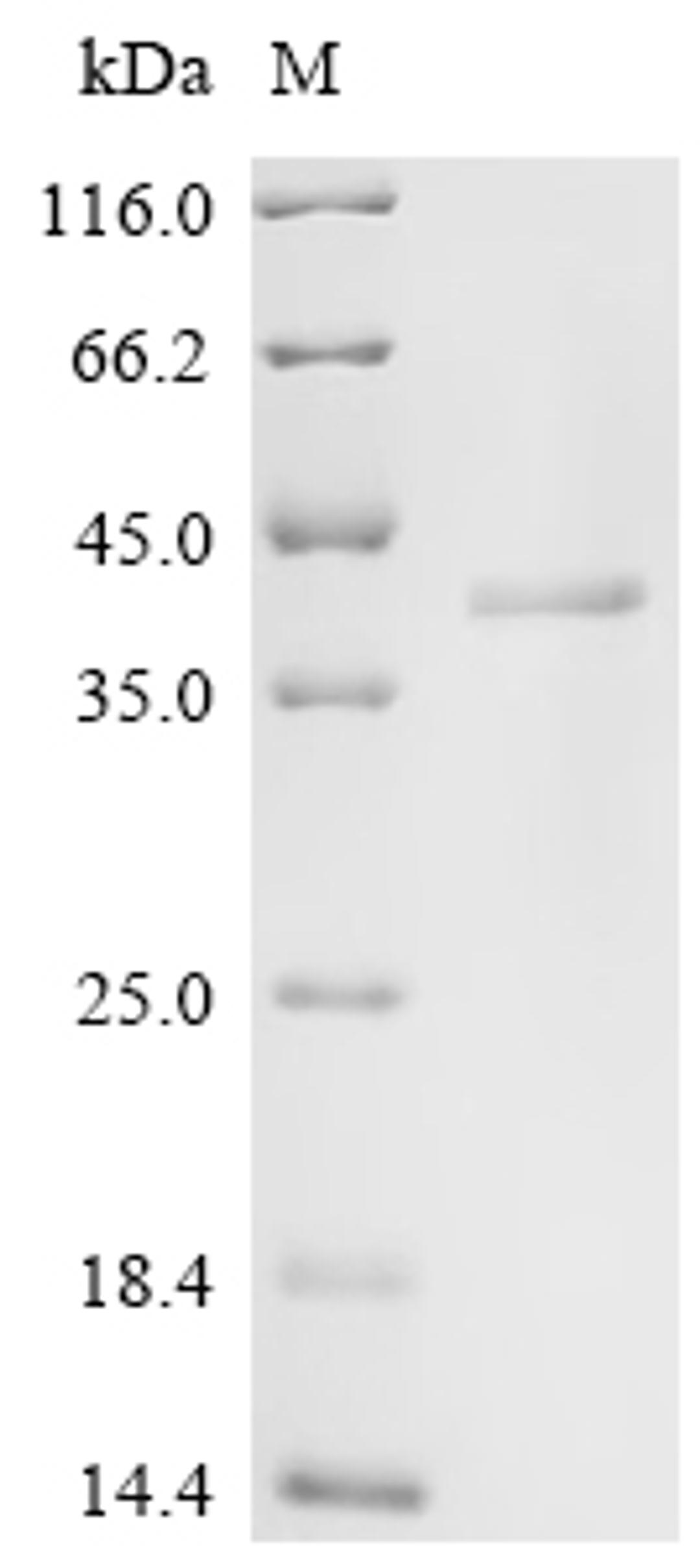 (Tris-Glycine gel) Discontinuous SDS-PAGE (reduced) with 5% enrichment gel and 15% separation gel.