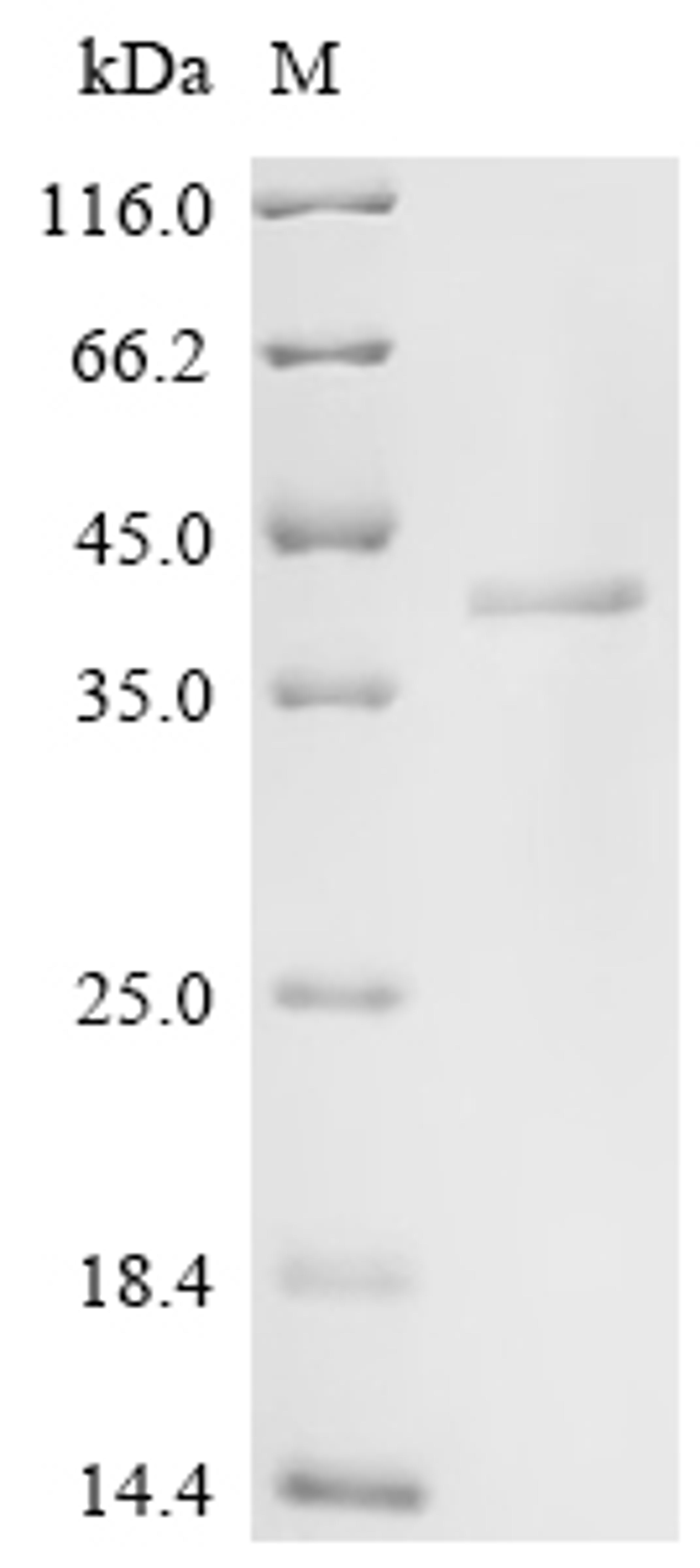 (Tris-Glycine gel) Discontinuous SDS-PAGE (reduced) with 5% enrichment gel and 15% separation gel.