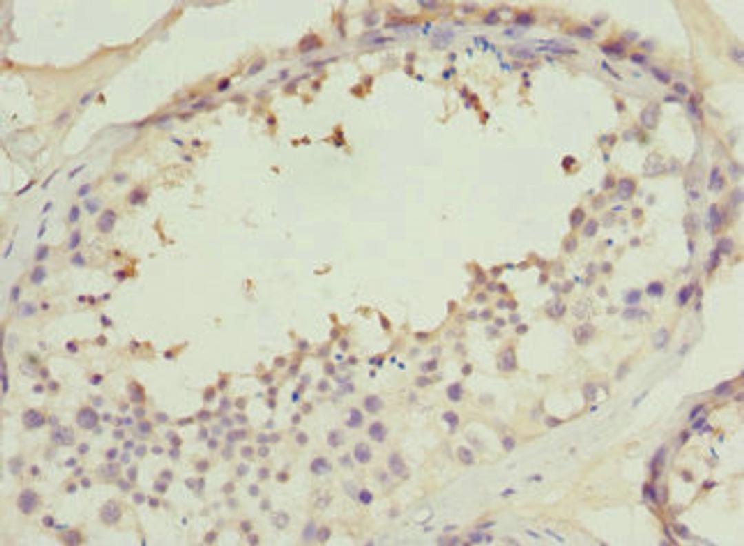Immunohistochemistry of paraffin-embedded human testis tissue using CSB-PA830420ESR2HU at dilution of 1:100