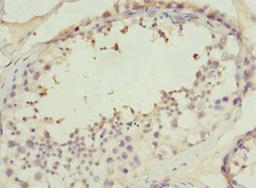Immunohistochemistry of paraffin-embedded human testis tissue using CSB-PA830420ESR2HU at dilution of 1:100