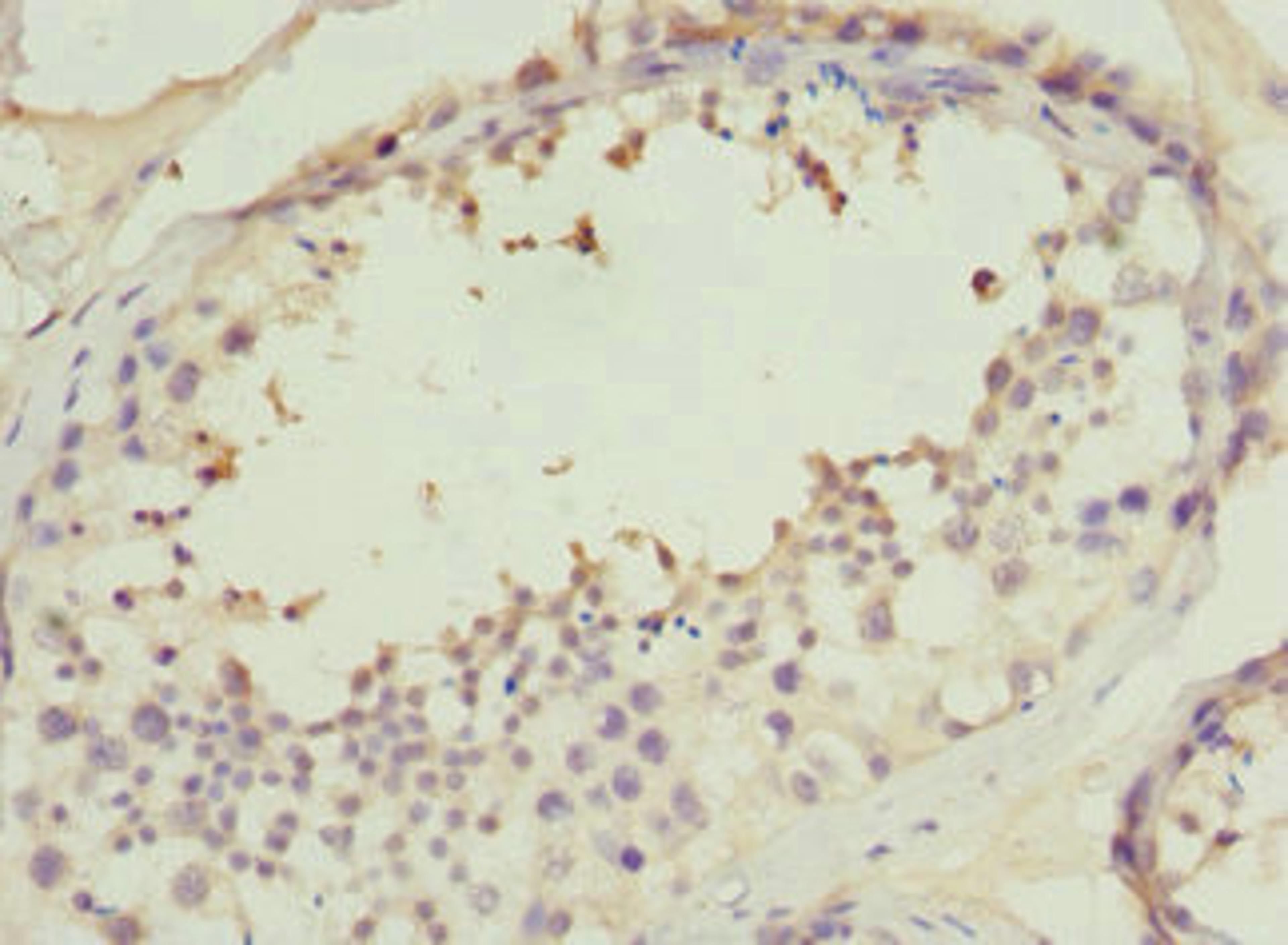 Immunohistochemistry of paraffin-embedded human testis tissue using CSB-PA830420ESR2HU at dilution of 1:100