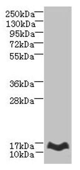 Western blot. All lanes: MTHFD2L antibody at 6µg/ml + Mouse lung tissue. Secondary. Goat polyclonal to rabbit IgG at 1/10000 dilution. Predicted band size: 38, 32, 8, 25, 33 kDa. Observed band size: 14 kDa