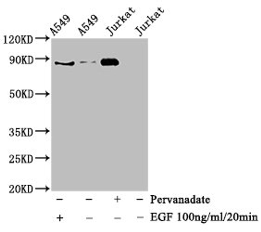 Western Blot. Positive WB detected in A549 whole cell lysate,Jurkat whole cell lysate(treated with EGF or Pervanadate). All lanes Phospho-STAT3 antibody at 0.925μg/ml. Secondary. Goat polyclonal to rabbit IgG at 1/50000 dilution. Predicted band size: 88 KDa. Observed band size: 88 KDa.