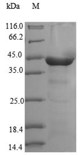 (Tris-Glycine gel) Discontinuous SDS-PAGE (reduced) with 5% enrichment gel and 15% separation gel.